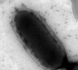 Listeria monocytogenes