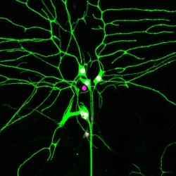 Image of neuron labeled by a green fluorescent protein 