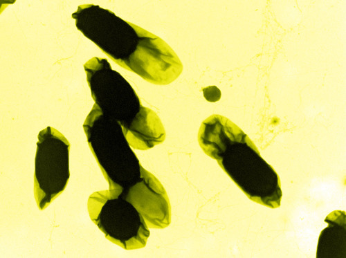 Micrographic portrait of a microbe