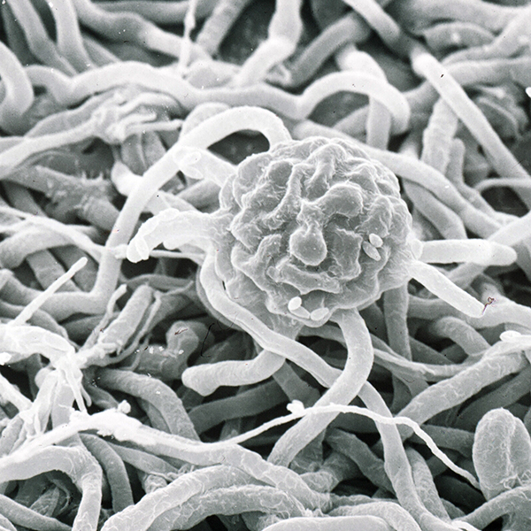 Microscopic view of grapevine powdery mildew