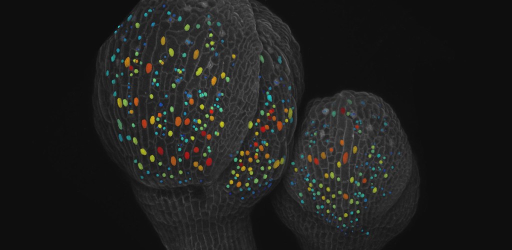 Cells of two flower buds