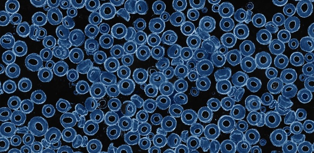 Microscopic view of vortex-ring particles