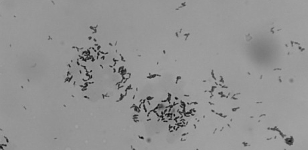 Microbes under a microscope