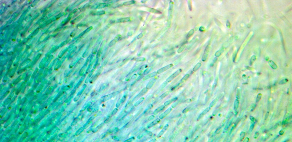 Anthocerotibacter panamensis under a microscope