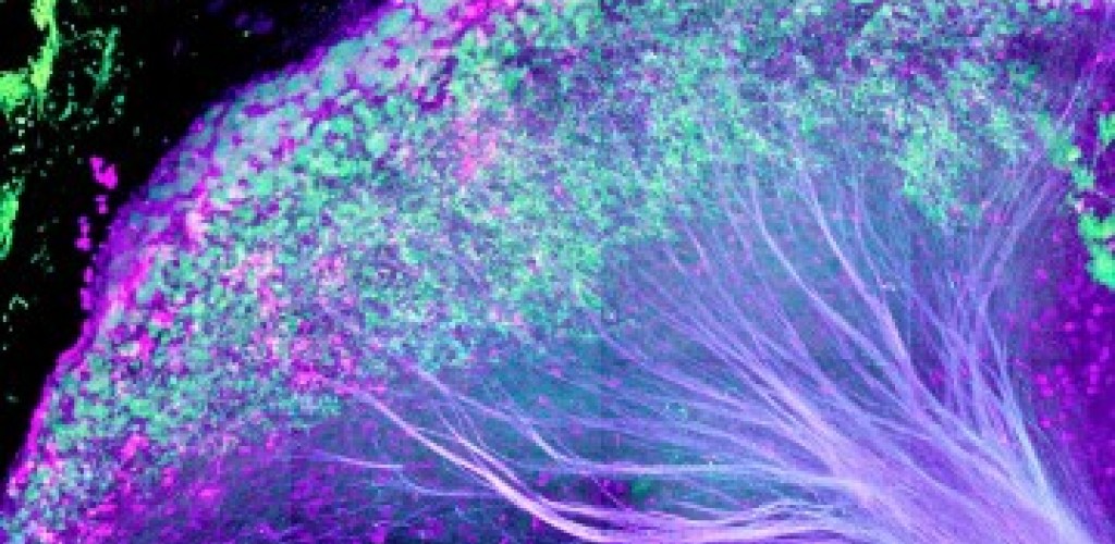 The lateral habenula in the mouse brain, with axons streaming down to dopaminergic and serotonergic centers.