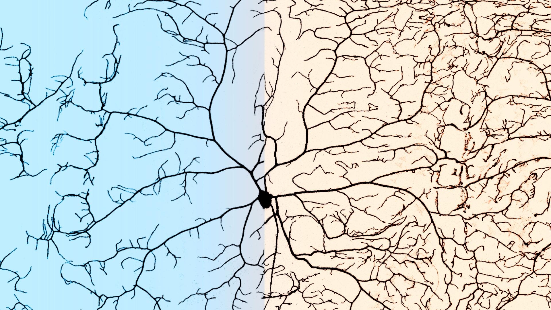 A microscopic shot of dendrites growing out of a single neuron 