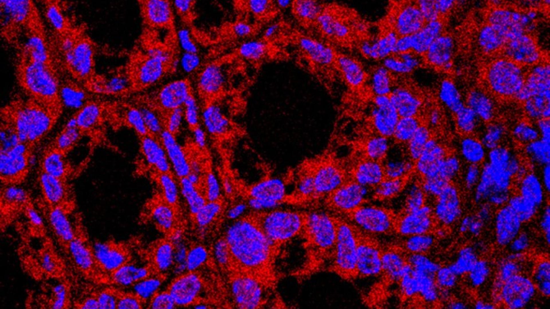 Sphingolipids, derived from bacteria in the intestine, appear to ameliorate problematic fattiness of the liver.