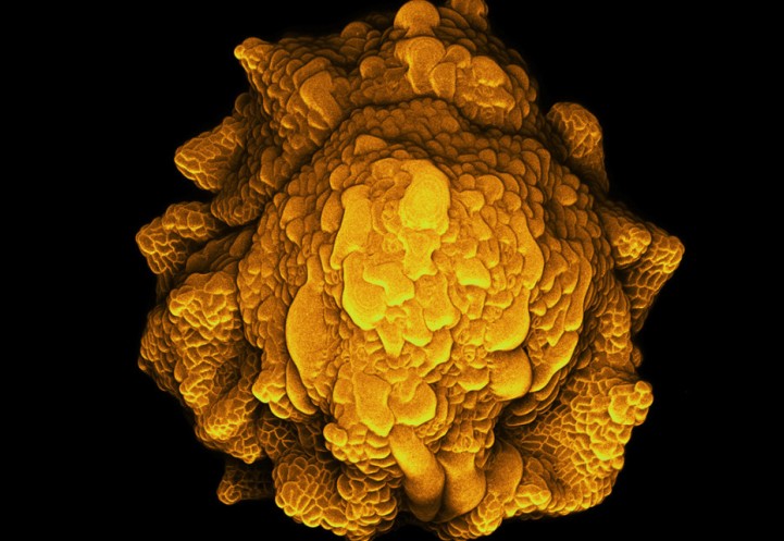 Microscopy image of a mutant flower bud with wrinkled and irregular sepals
