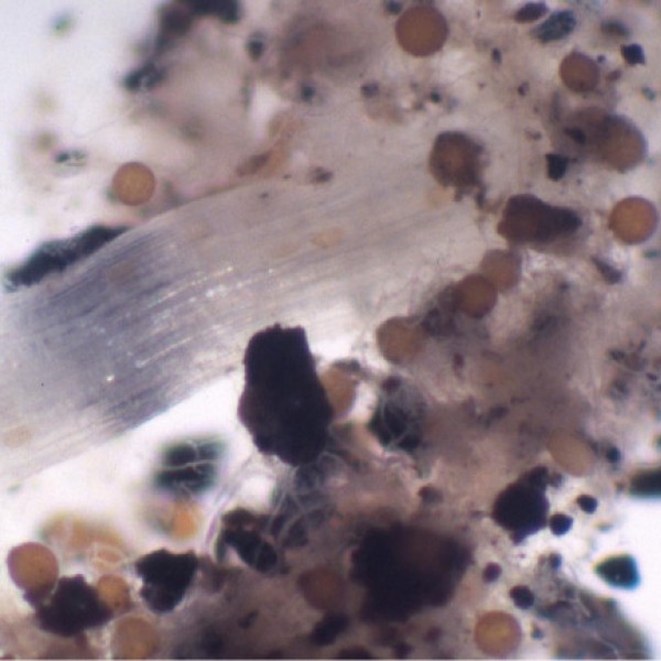 A plant root under the microscope