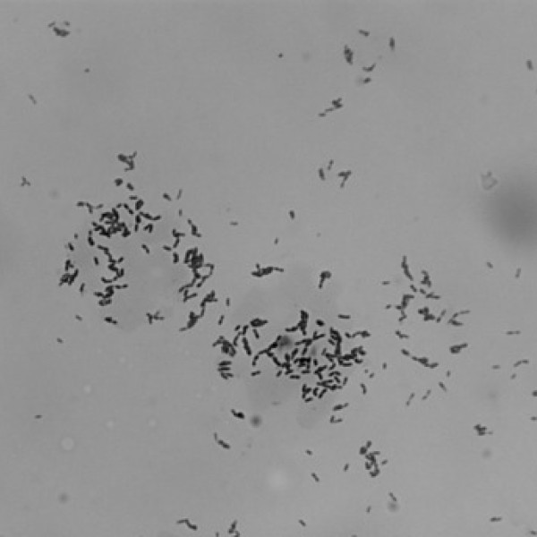 Microbes under a microscope