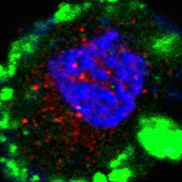 A rat cell under a microscope that is stained blue where the nucleus is and green where insulin is expressed