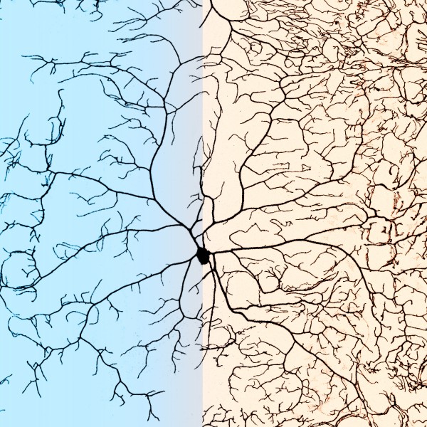 A microscopic shot of dendrites growing out of a single neuron 
