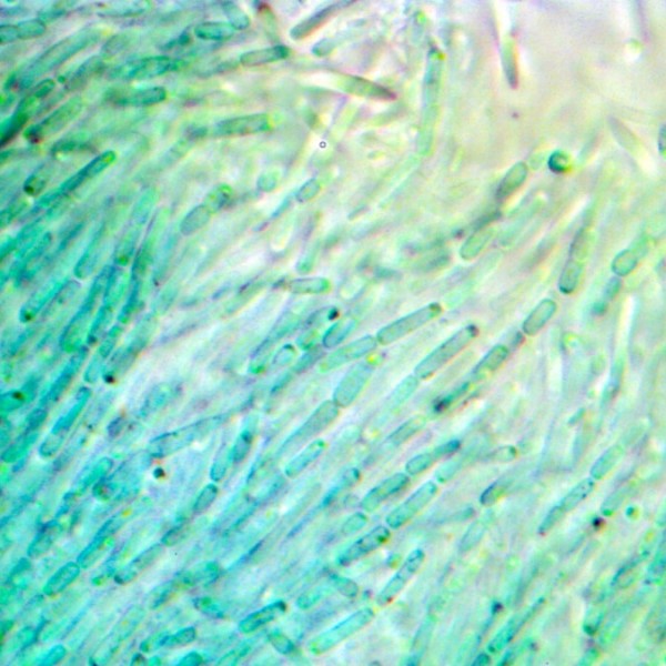 Anthocerotibacter panamensis under a microscope