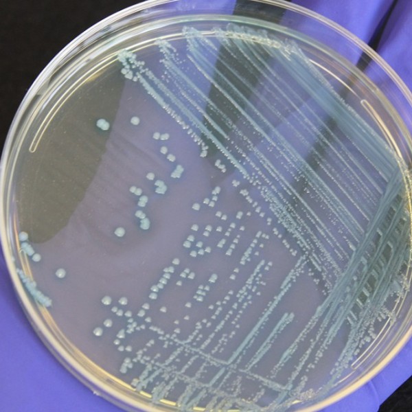 Listeria on a petri dish held by a purple gloved hand