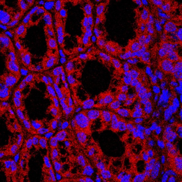Sphingolipids, derived from bacteria in the intestine, appear to ameliorate problematic fattiness of the liver.