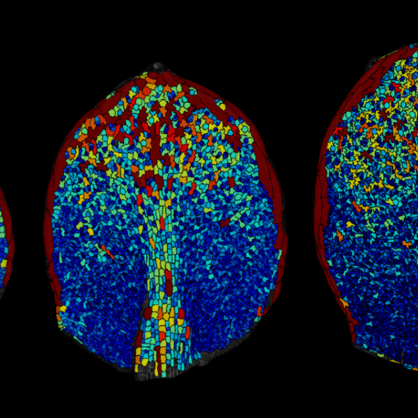 Scan of a arabidopsis leaf
