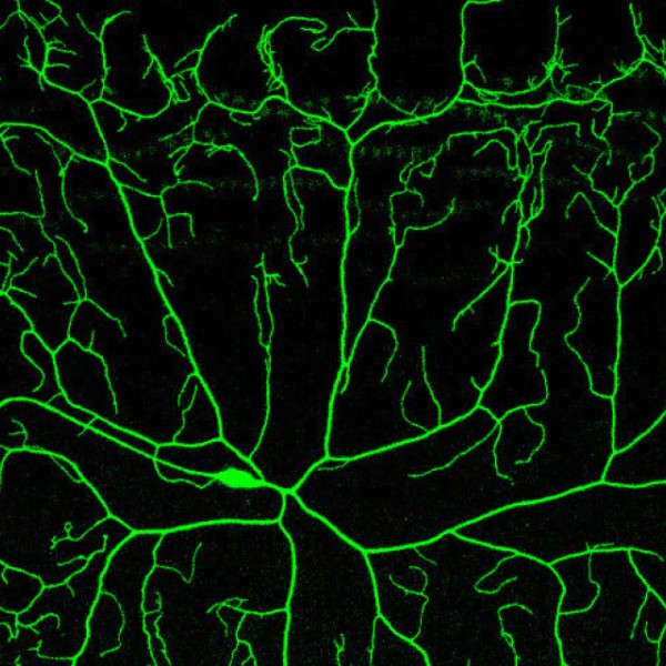 A single Drosophila larval sensory neuron labeled by the MAGIC technique
