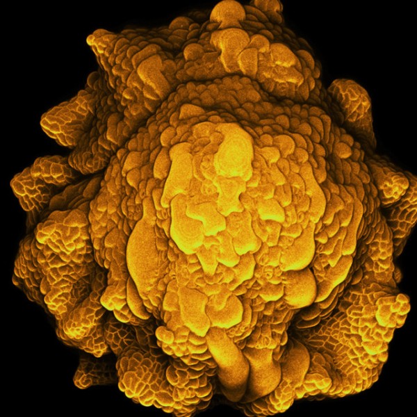 Microscopy image of a mutant flower bud with wrinkled and irregular sepals
