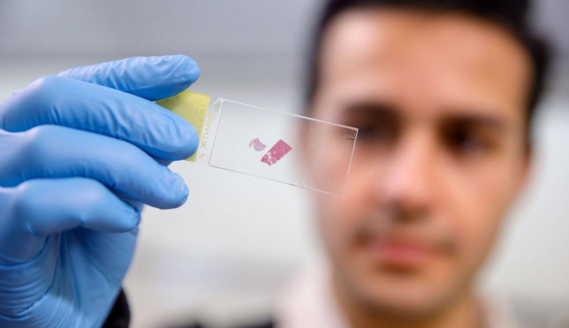 Scientist inspects a microscope slide with a gloved hand
