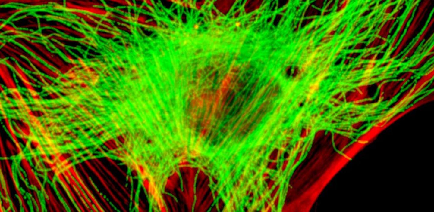 microscope image showing fluorescing actin and microtubule filaments