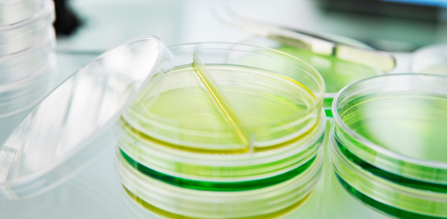 Stack of Petri dishes in a lab