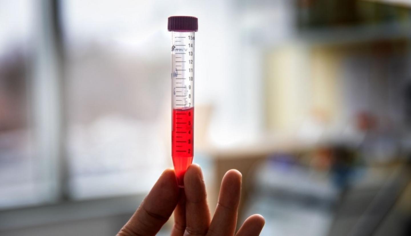 A vial&nbsp;of beet juice. 