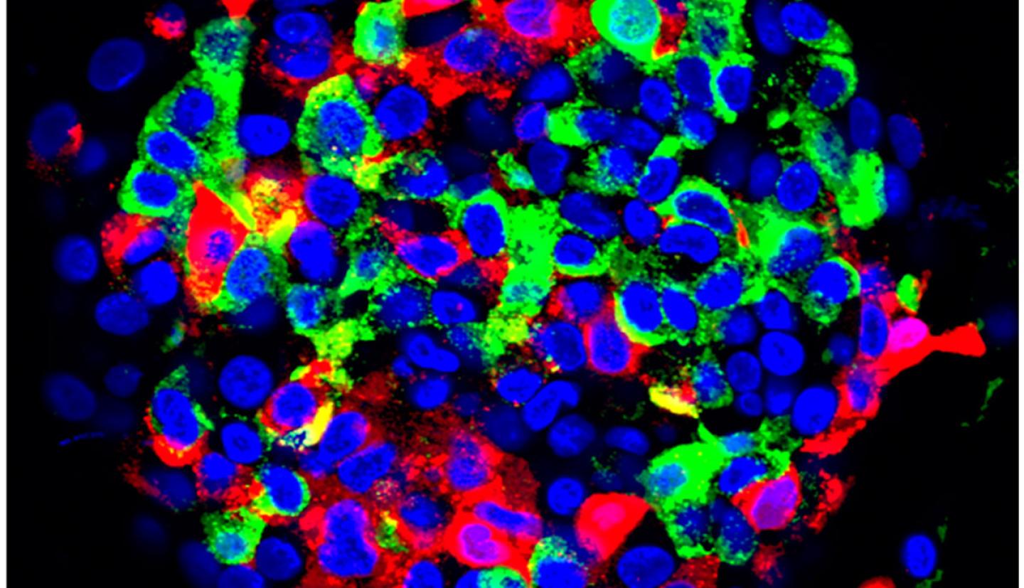 An immunofluorescent staining image of human stem cell