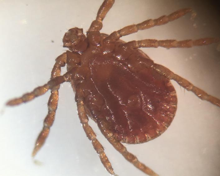microscope view of a brown tick