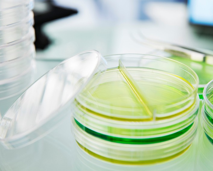 Stack of Petri dishes in a lab