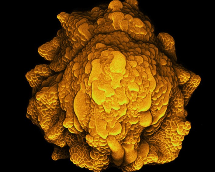  flower bud with wrinkled and irregular sepals