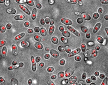 yeast cells
